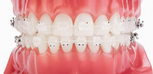 Dây cung sứ tròn/ vuông