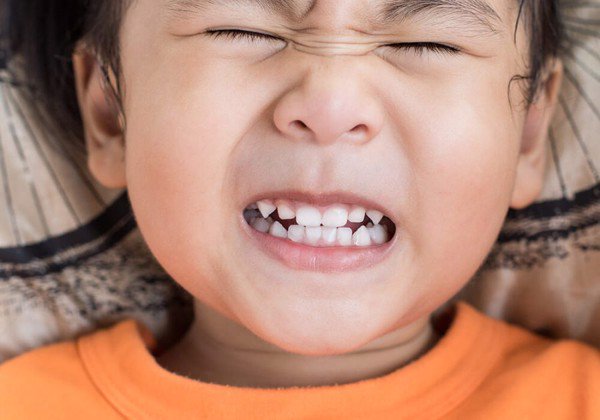 Hậu quả nặng nề tật nghiến răng và Máng chống nghiến - phép màu cho giấc ngủ ngon